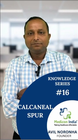 KNOWLEDGE SERIES #16-CALCANEAL  SPUR  cover image