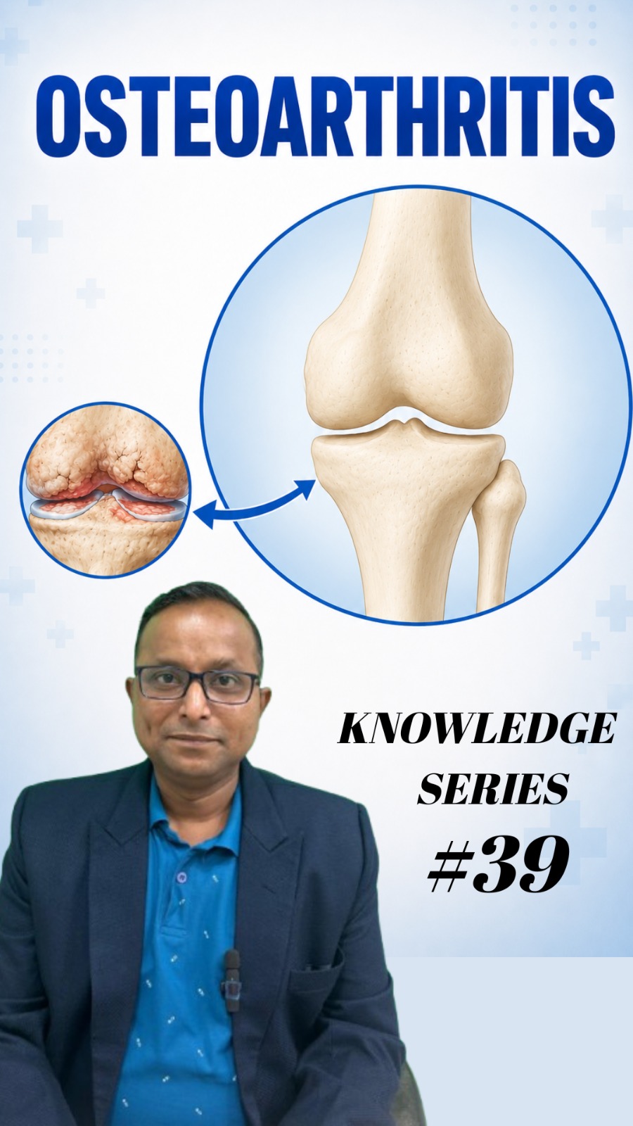 KNOWLEDGE SERIES #39 - OSTEOARTHRITIS cover image